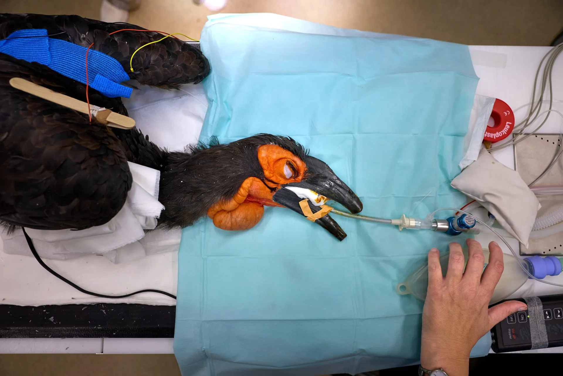 A southern ground hornbill under anaesthetic on an operating table covered with a blue drape, with a breathing tube and its beak protected