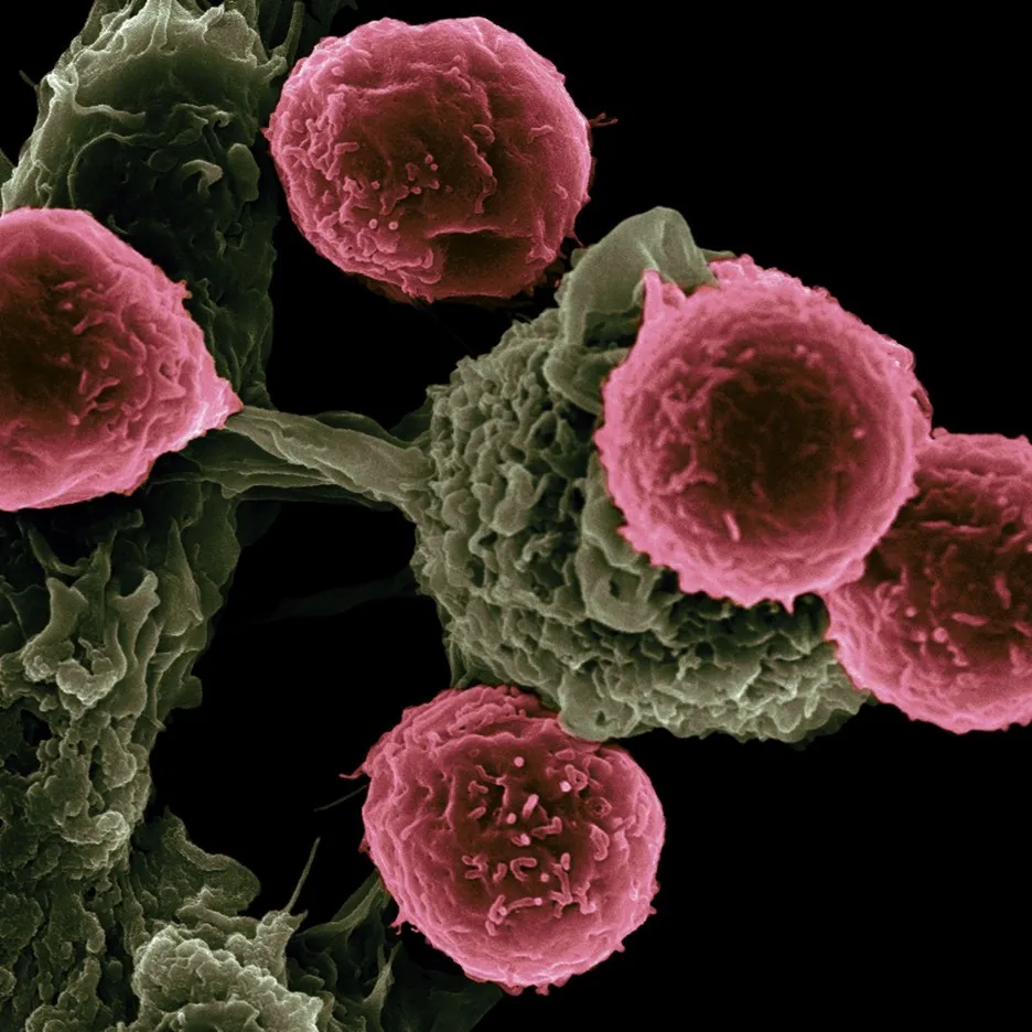 Electron microscope image: dendritic cells, in green, surrounded by T cells, in pink