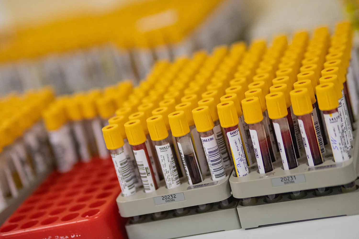 Dozens of yellow-capped blood sample tubes with barcode labels in laboratory racks