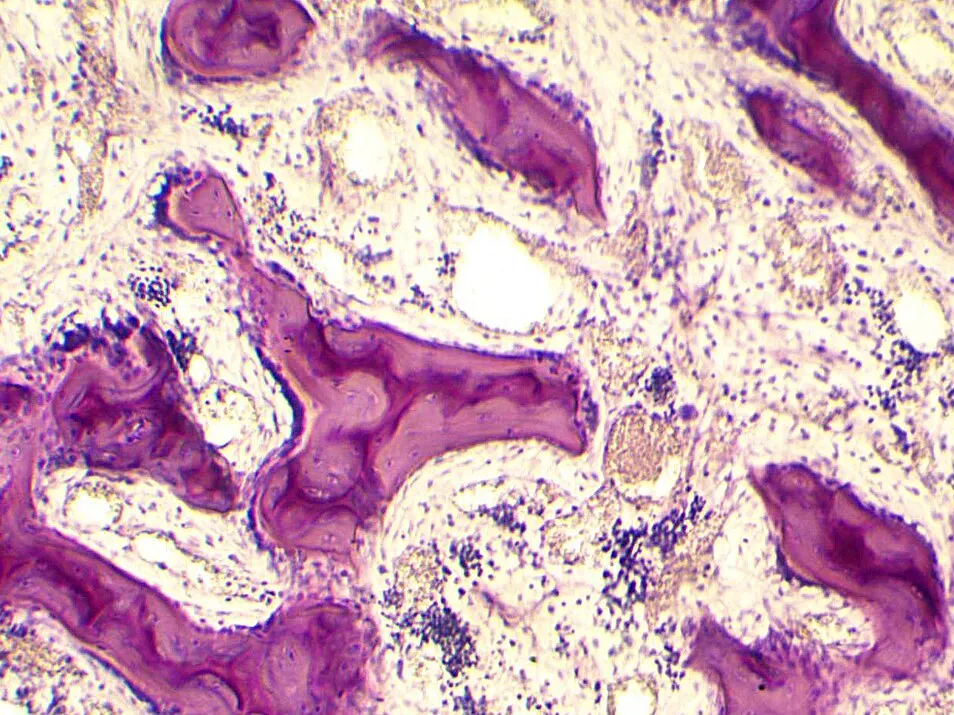Microscope image of spongy bone: purple trabeculae surrounded by bone marrow cells