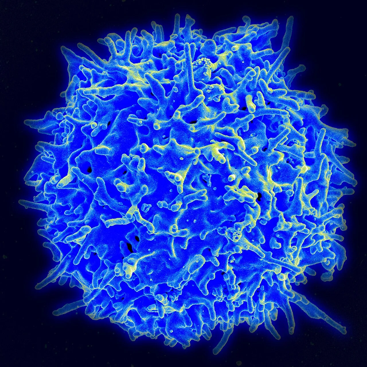A human T cell under the electron microscope, in blue