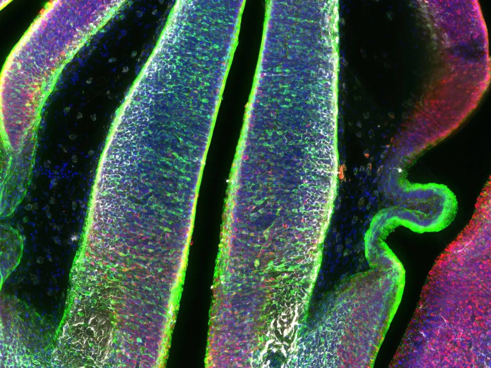 Microscope image of bands of brain tissue in blue, red and purple, edged with fluorescent green lines